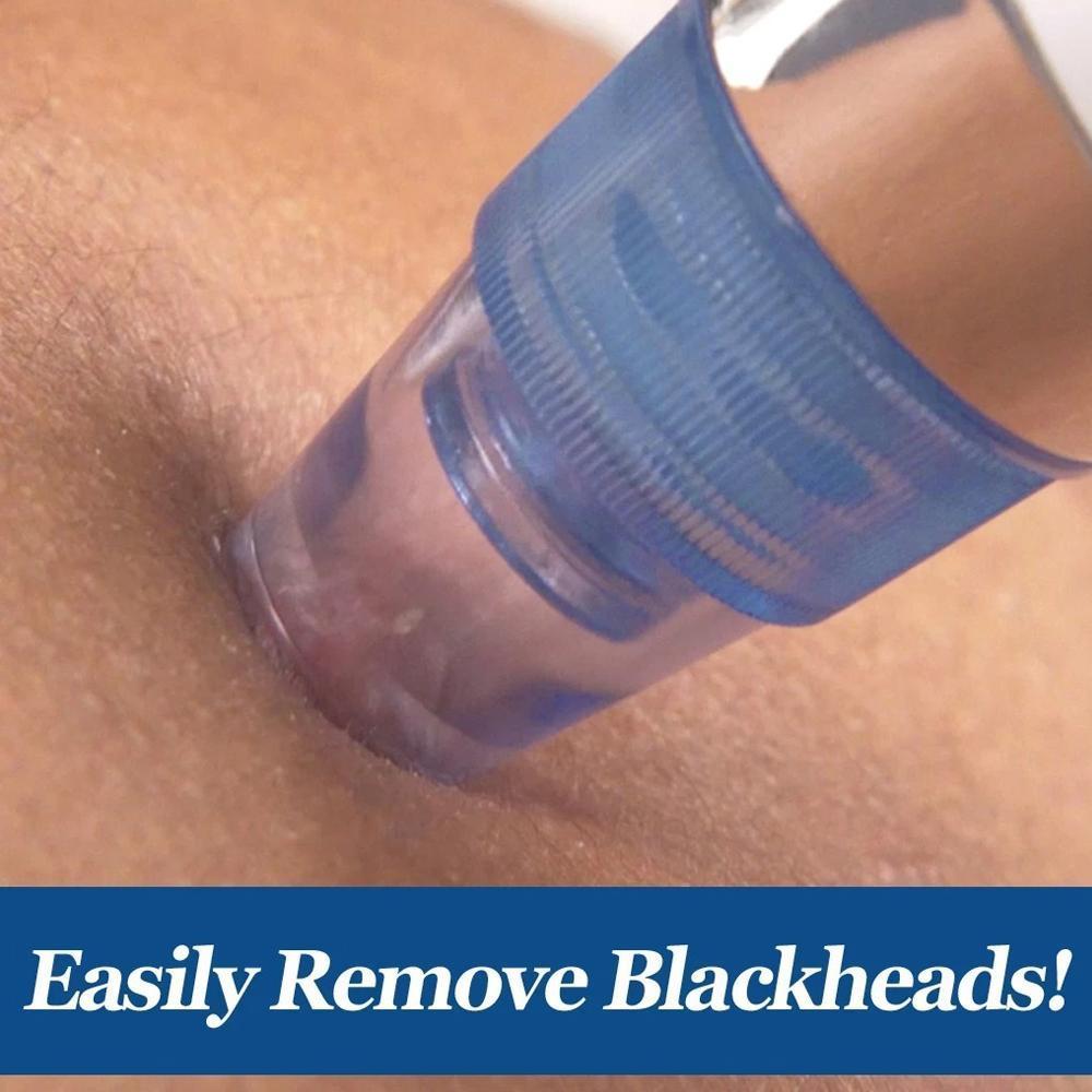 0351 -4 In 1 Blackhead Whitehead Extractor Remover Device Acne Pimple Pore Cleaner (Vacuum Suction Tool) - SkyShopy 0351 -4 In 1 Blackhead Whitehead Extractor Remover Device Acne Pimple Pore Cleaner (Vacuum Suction Tool) - SkyShopy